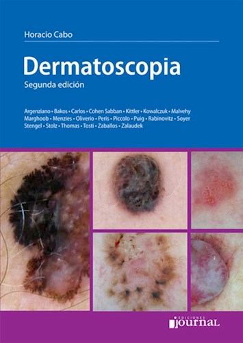 E-Book Dermatoscopia Ed.2 (eBook)