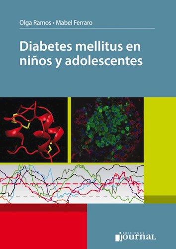 E-Book Diabetes mellitus en niños y adolescentes  (eBook)
