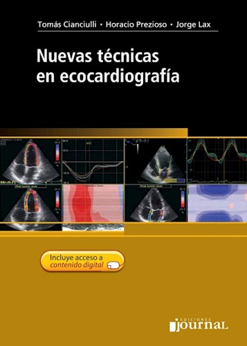 E-Book Nuevas técnicas en ecocardiografía (eBook)