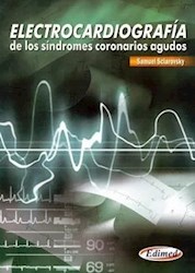 Papel Electrocardiografía De Los Síndromes Coronarios Agudos