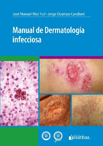 Papel Manual de Dermatología infecciosa
