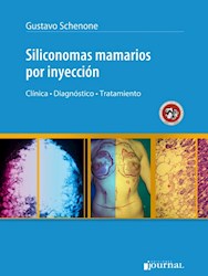 E-Book Siliconomas Mamarios Por Inyección (E-Book)