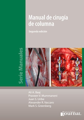 Papel Manual de Cirugía de Columna