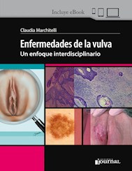 Papel Enfermedades De La Vulva