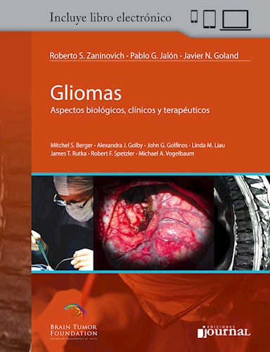  Gliomas (E-Book)