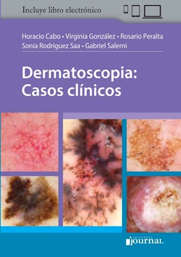 E-Book Dermatoscopia: Casos clínicos (E-Book)