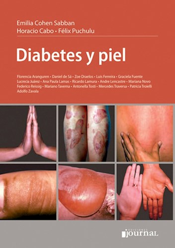 E-Book Diabetes y piel E-Book