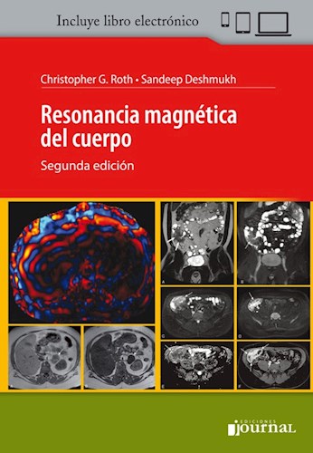 E-Book Resonancia Magnética del Cuerpo Ed.2  (eBook)
