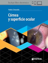 E-Book Córnea Y Superficie Ocular (Ebook)