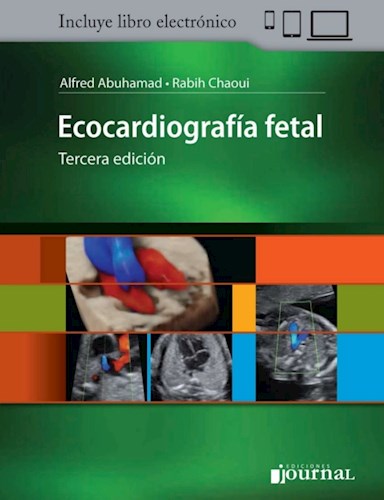 E-Book Ecocardiografía fetal (eBook)