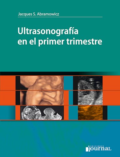 Papel Ultrasonografía en el primer trimestre