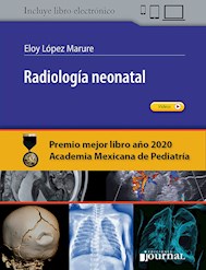 Papel Radiología Neonatal