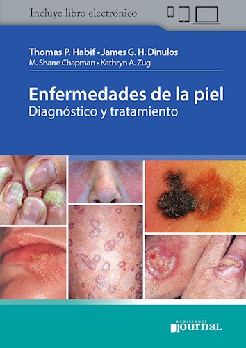 Enfermedades de la piel por Habif, - 9789874922212 - Journal Enfermedades de la piel por Habif, - 9789874922212 - Journal