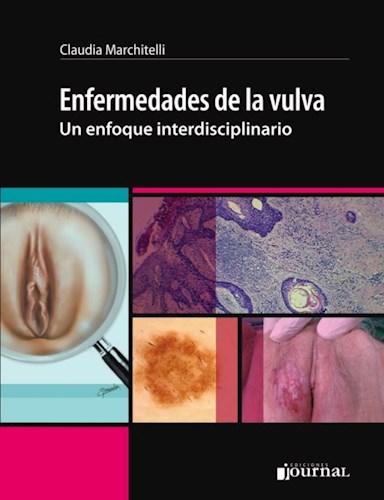 E-Book Enfermedades de la vulva (eBook)