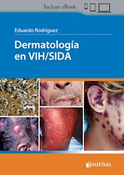 E-Book Dermatología En Vih/Sida (Ebook)