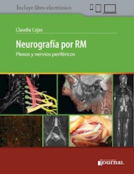 Papel Neurografía Por Rm