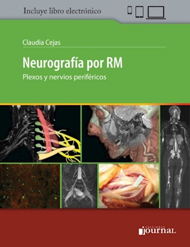 E-Book Neurografía por RM (eBook)