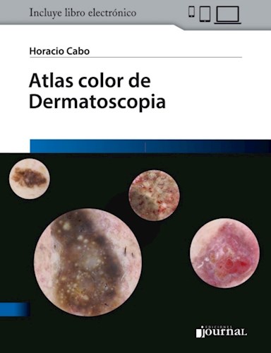 E-Book Atlas color de Dermatoscopia (eBook)