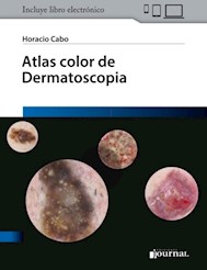 E-Book Atlas Color De Dermatoscopia (E-Book)