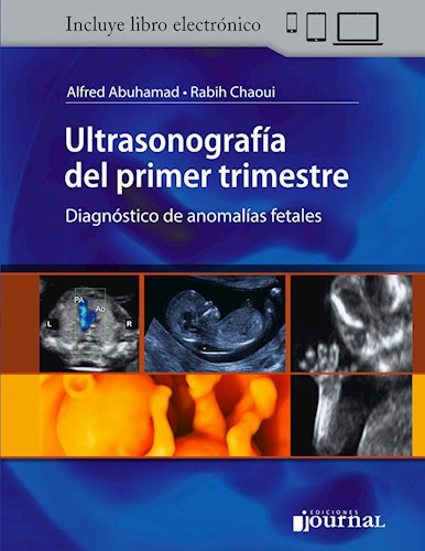 Papel Ultrasonografía del primer trimestre