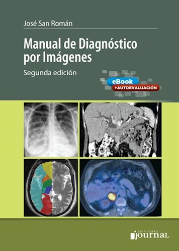 E-Book Manual de Diagnóstico por Imágenes (eBook) Ed.2º