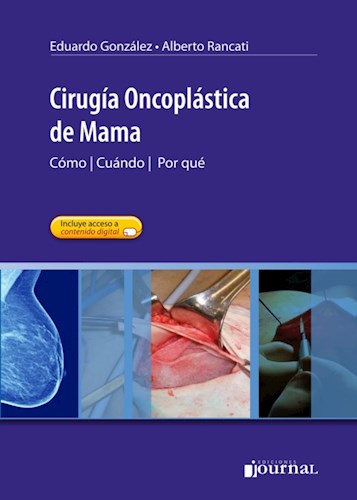 E-Book Cirugía Oncoplástica de Mama (eBook)