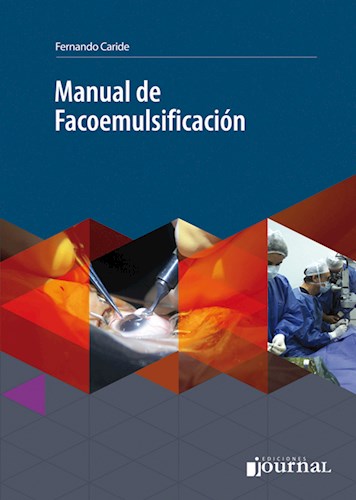 E-Book Manual de Facoemulsificación (eBook)