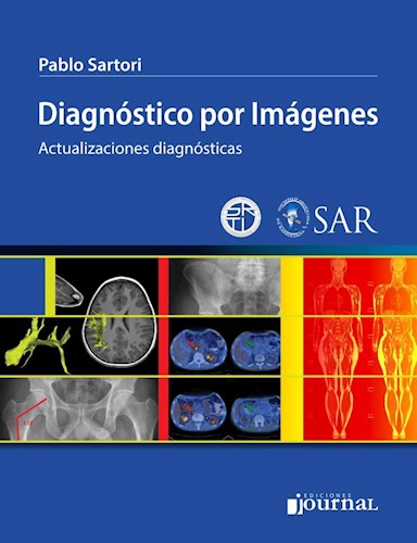 E-Book Diagnóstico por imágenes (eBook)