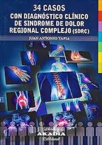 Papel 34 Casos con Diagnóstico Clínico de Síndrome de Dolor Regional Complejo (SDRC)