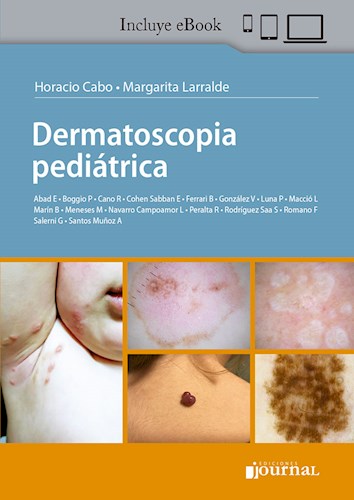 E-Book Dermatoscopia pediátrica (eBook)