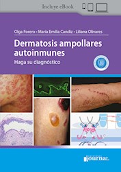 E-Book Dermatosis Ampollares Autoinmunes (Ebook)