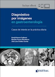 E-Book Diagnóstico Por Imágenes En Gastroenterología (Ebook)