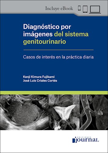 E-Book Diagnóstico por imágenes del sistema genitourinario (eBook)