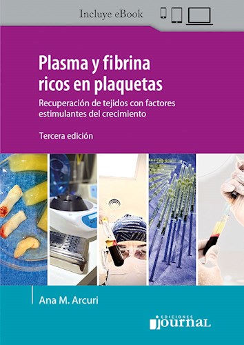 E-Book Plasma y fibrina ricos en plaquetas Ed.3 (eBook)