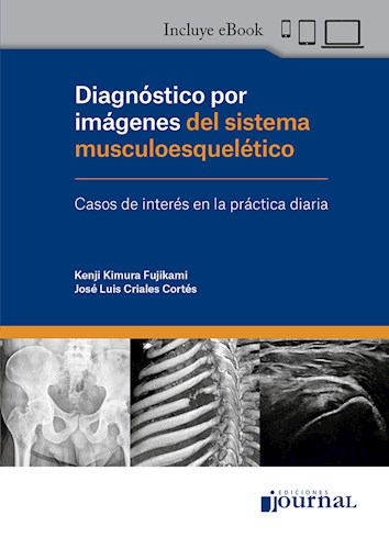 E-Book Diagnóstico por imágenes del sistema musculoesquelético (eBook)