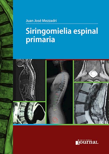 Papel Siringomielia espinal primaria