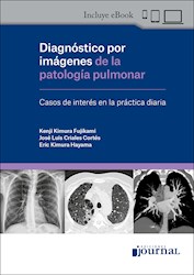 E-Book Diagnóstico Por Imágenes De La Patología Pulmonar (Ebook)