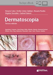 E-Book Dermatoscopia Ed.3 (Ebook)