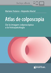 Papel Atlas De Colposcopia