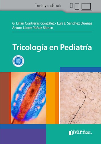 Papel Tricología en Pediatría