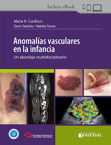 E-book Anomalías Vasculares en la Infancia (eBook)
