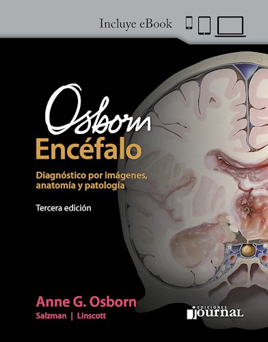 Papel Osborn. El Encéfalo Ed.3