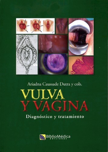 Papel Vulva y Vagina. Diagnóstico y tratamiento