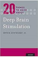 Papel 20 Things To Know About Deep Brain Stimulation