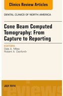 E-book Cone Beam Computed Tomography: From Capture To Reporting, An Issue Of Dental Clinics Of North America