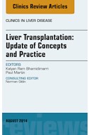 E-book Liver Transplantation: Update Of Concepts And Practice, An Issue Of Clinics In Liver Disease