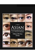 E-book Asian Blepharoplasty And The Eyelid Crease
