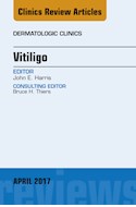 E-book Vitiligo, An Issue Of Dermatologic Clinics