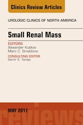 E-book Small Renal Mass, An Issue Of Urologic Clinics