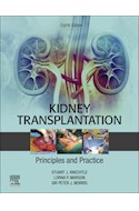 E-book Kidney Transplantation - Principles And Practice